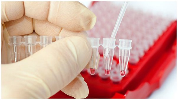 vih-sida-britanico-seria-el-jpg_604x0