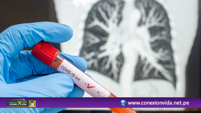 PLANTILLA ANUNCIOS CARABAYLLO