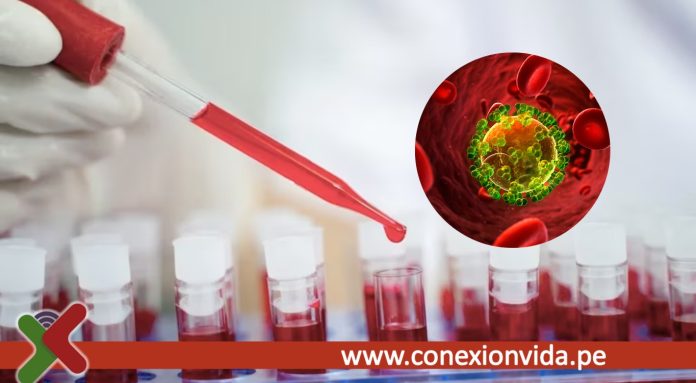 Avance contra el VIH hallan una proteína que ayuda al virus a permanecer latente