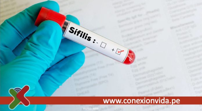 Los casos de sífilis aumentan en las Américas